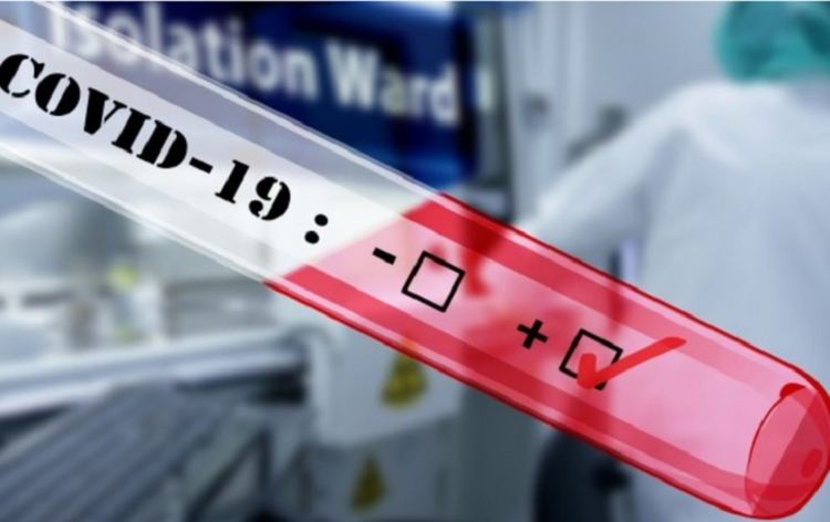 Още двама депутати с положителна проба за covid-19